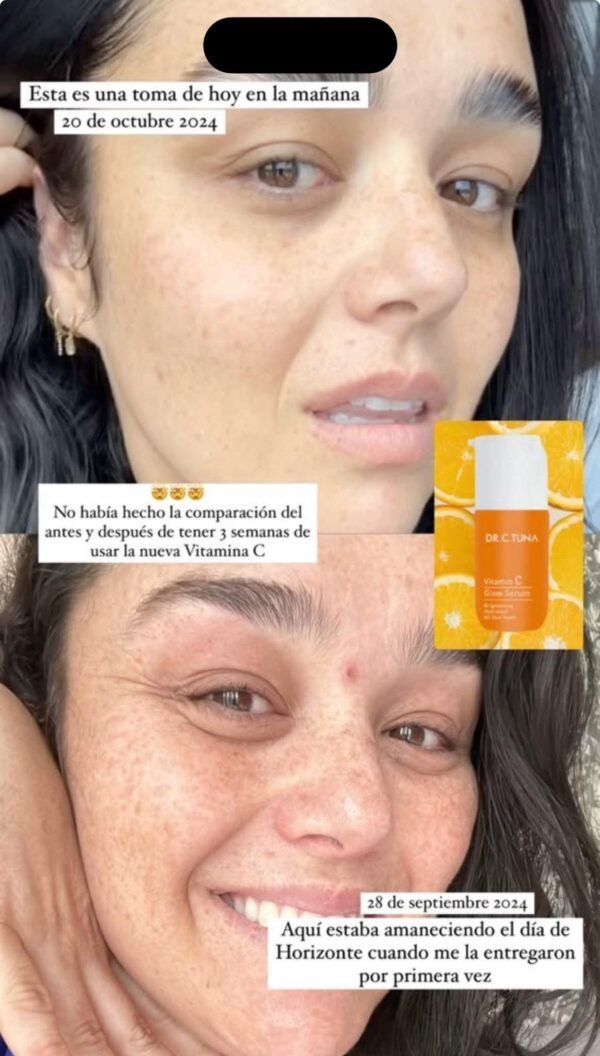 Serum de vitamina C