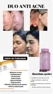TRATAMIENTO PARA EL ACNE